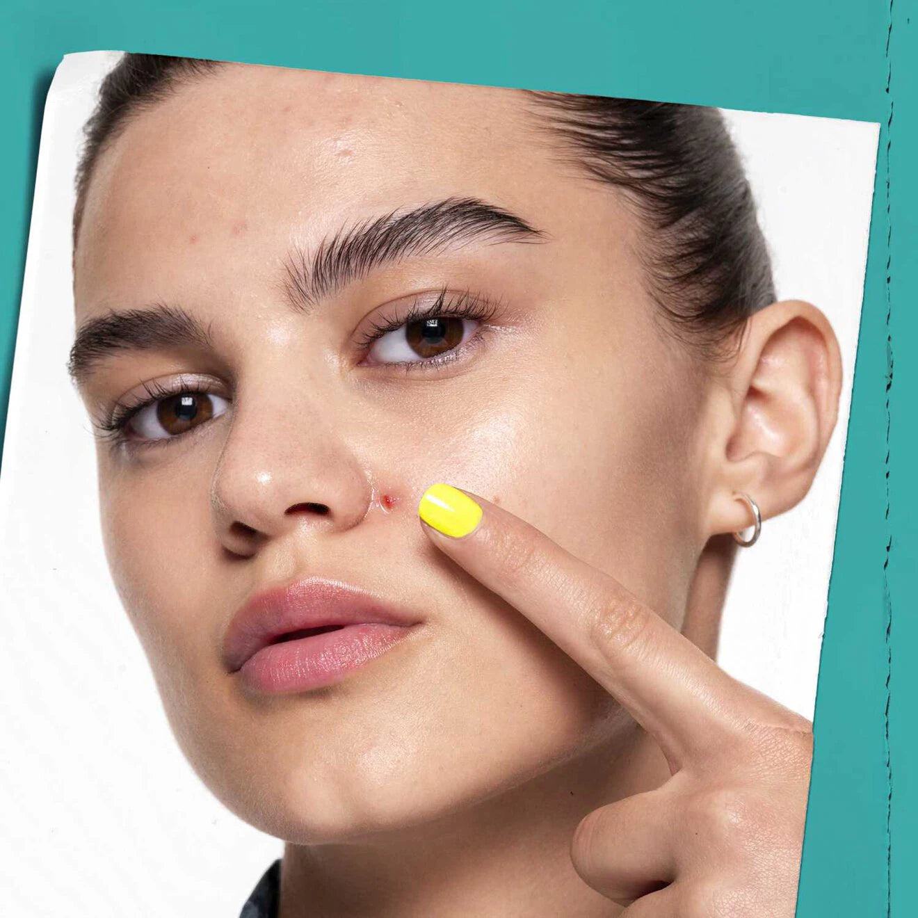 Truly Targeted Blemish-Clearing Solution with Salicylic Acid