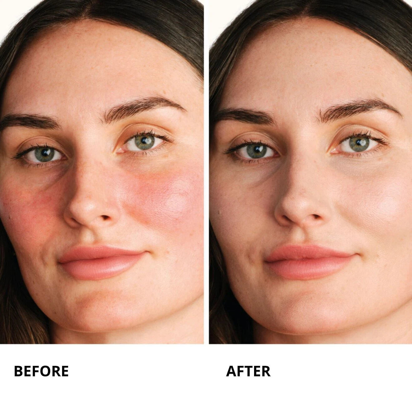 Centella Red Serum - Anti-Redness Concentrated Serum