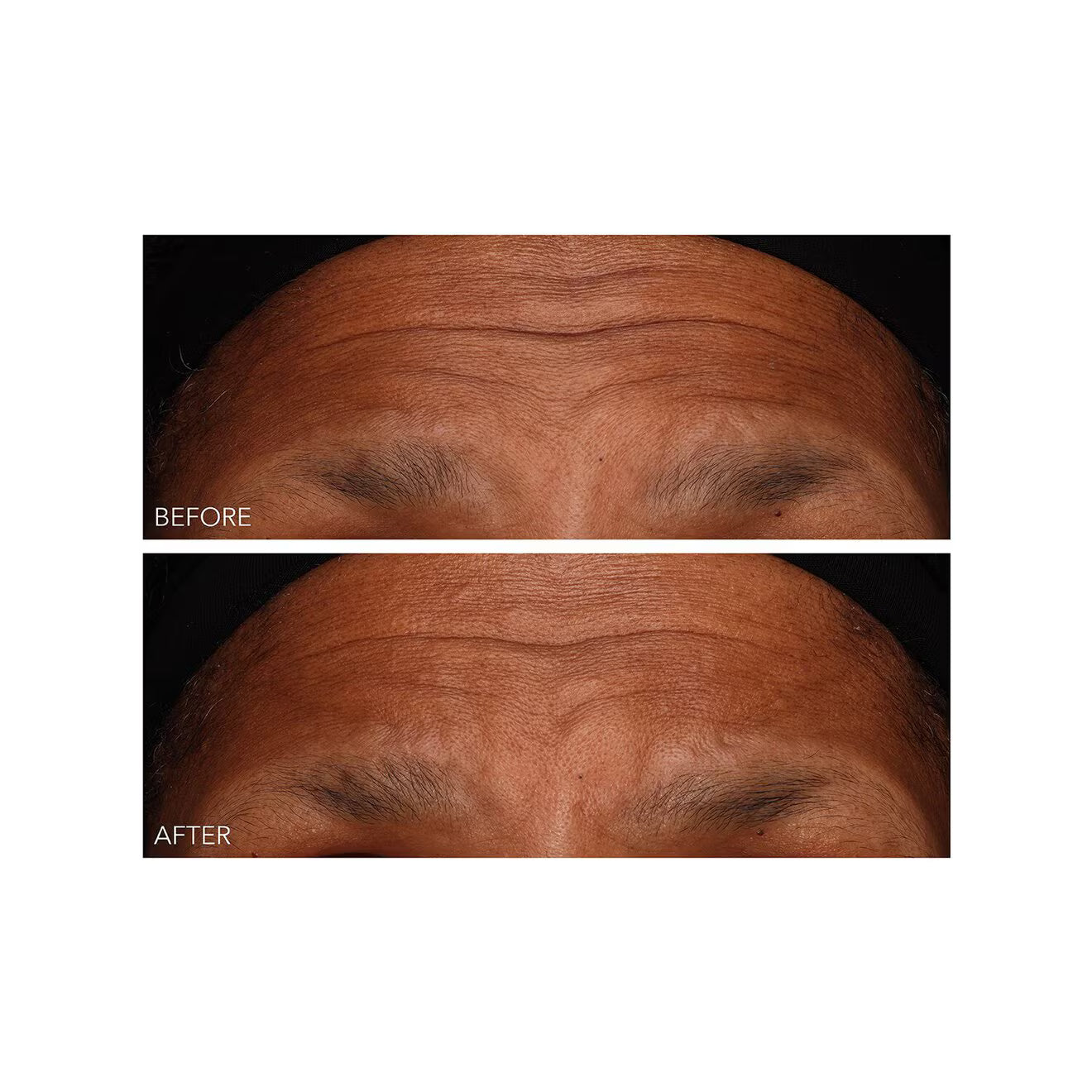 DermInfusions™ - Fill + Repair Serum