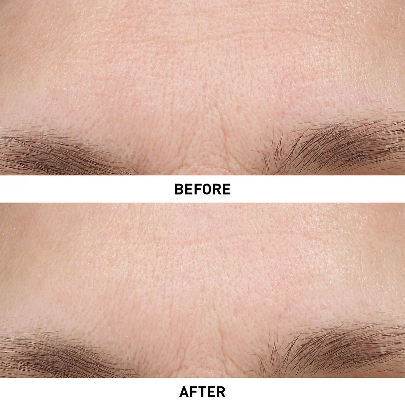 Ginseng Micro Shot Advanced 0.3% - Retexturizing Micro-Infusion Serum