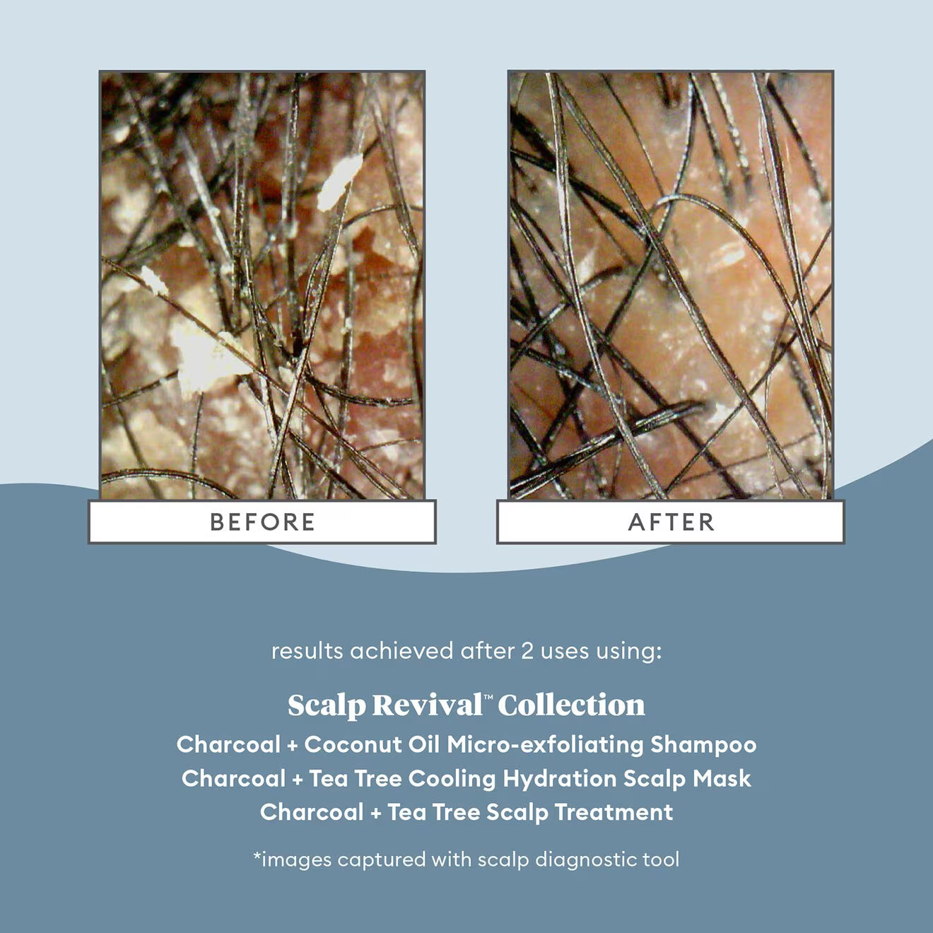 Scalp Revival™ Charcoal + Coconut Oil Micro-exfoliating Shampoo