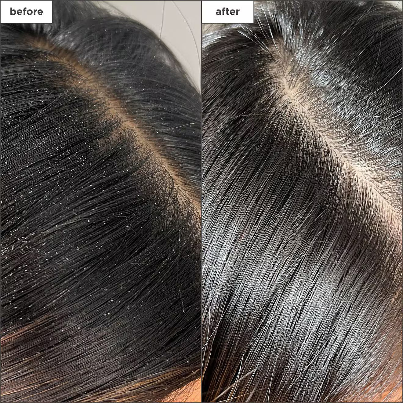 Scalp Revival™ Charcoal + Tea Tree Buildup Detox Spray
