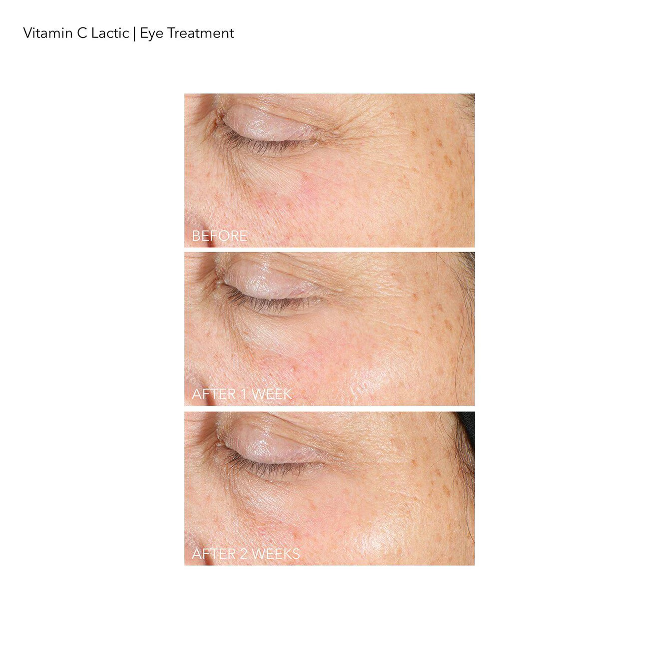 Vitamin C + Lactic Firm & Bright Eye Treatment