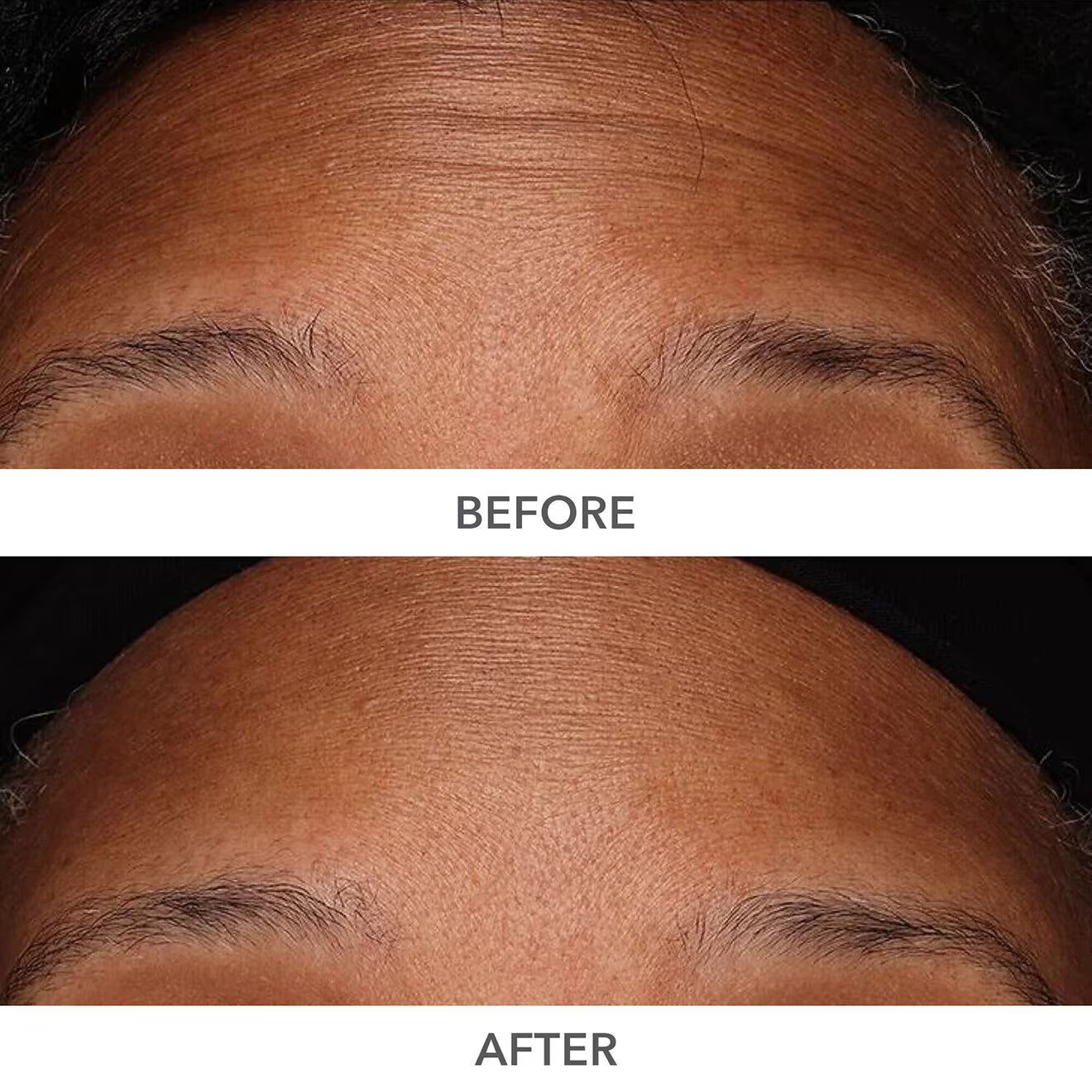 Derminfusions 3D Plump, Fill & Repair Kit (Lip Treatment, Serum & Eye Mask)