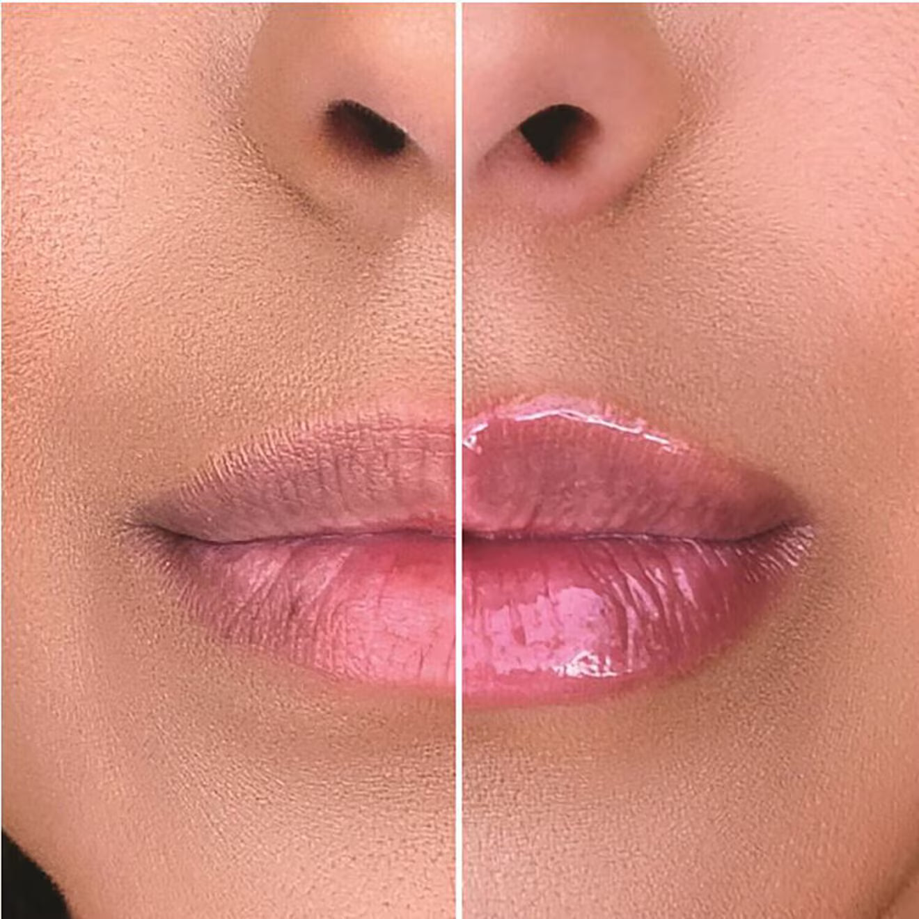 Lip Injection Duo