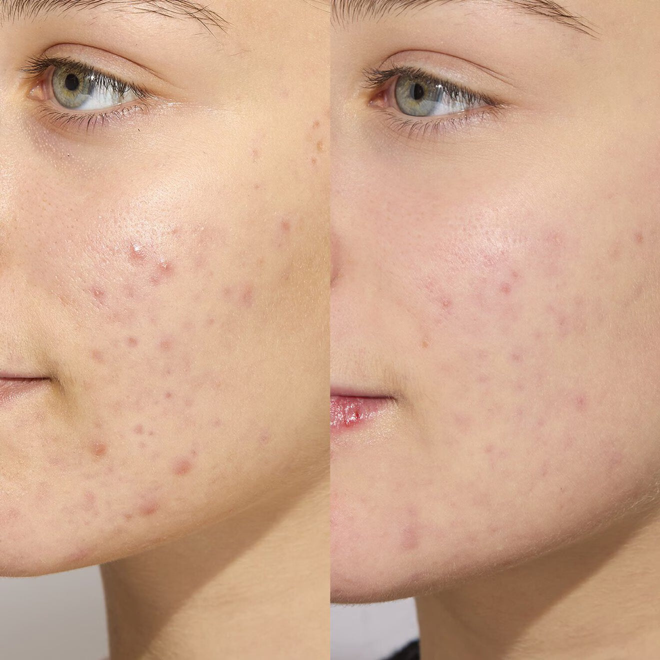 Vinopure Moisturizing Mattifying Fluid