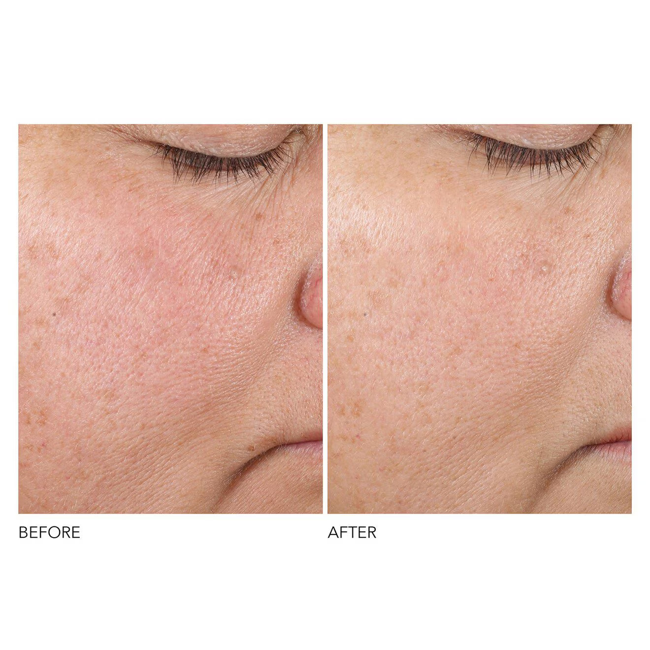 Advanced Retinol + Ferulic Texture Renewal Serum