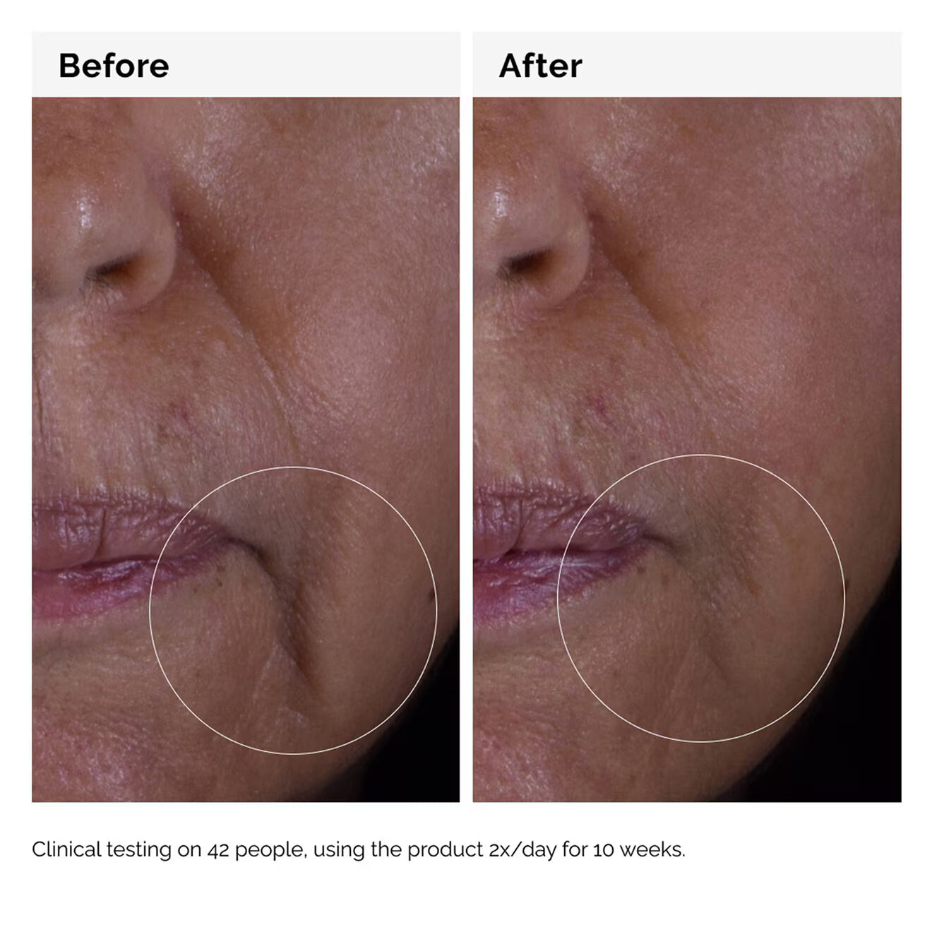 GF Solution 15% Serum