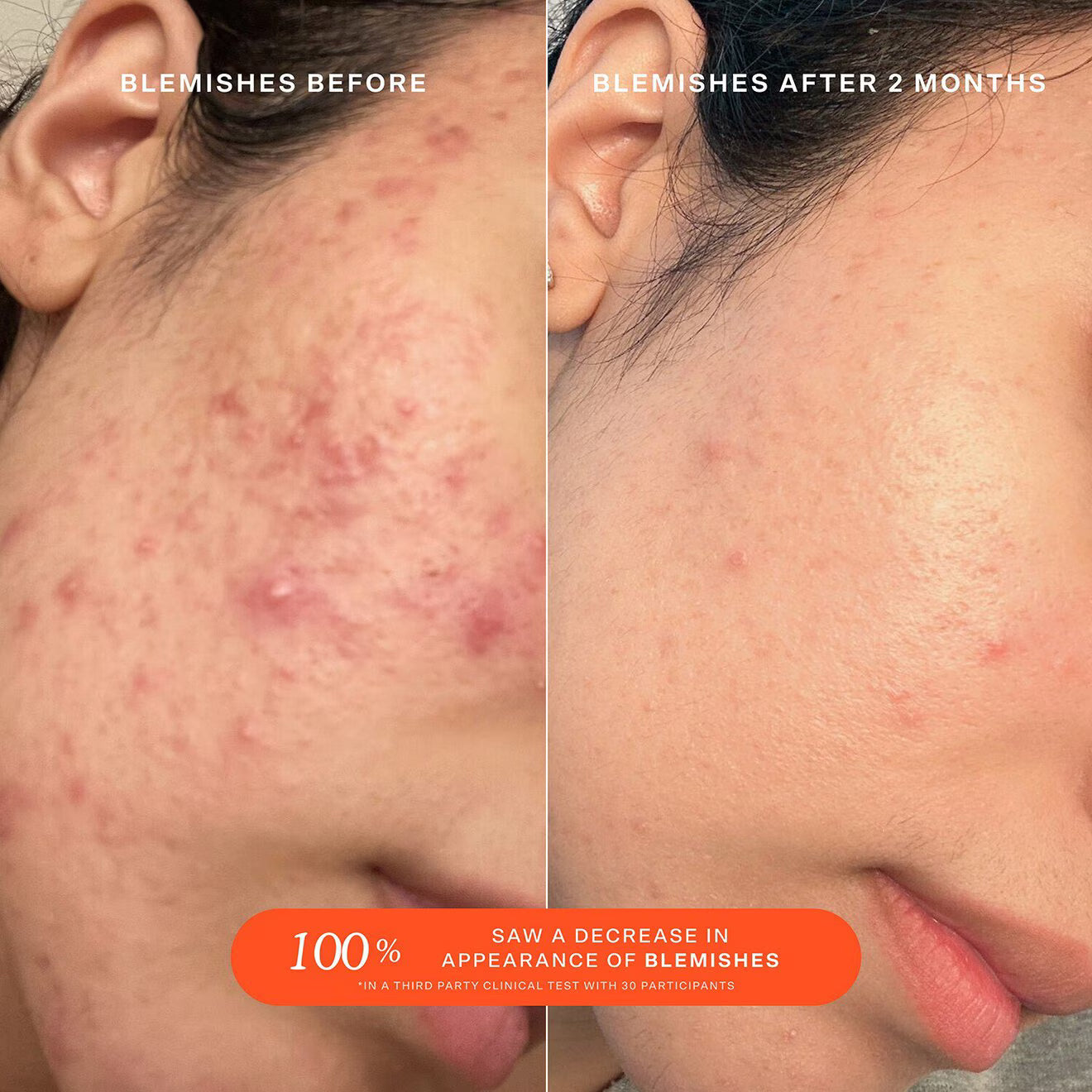 Mini SOS Daily Rescue Facial Spray