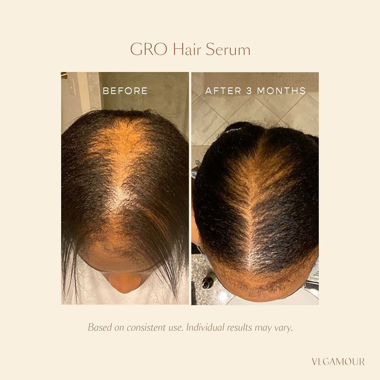 GRO Hair Serum
