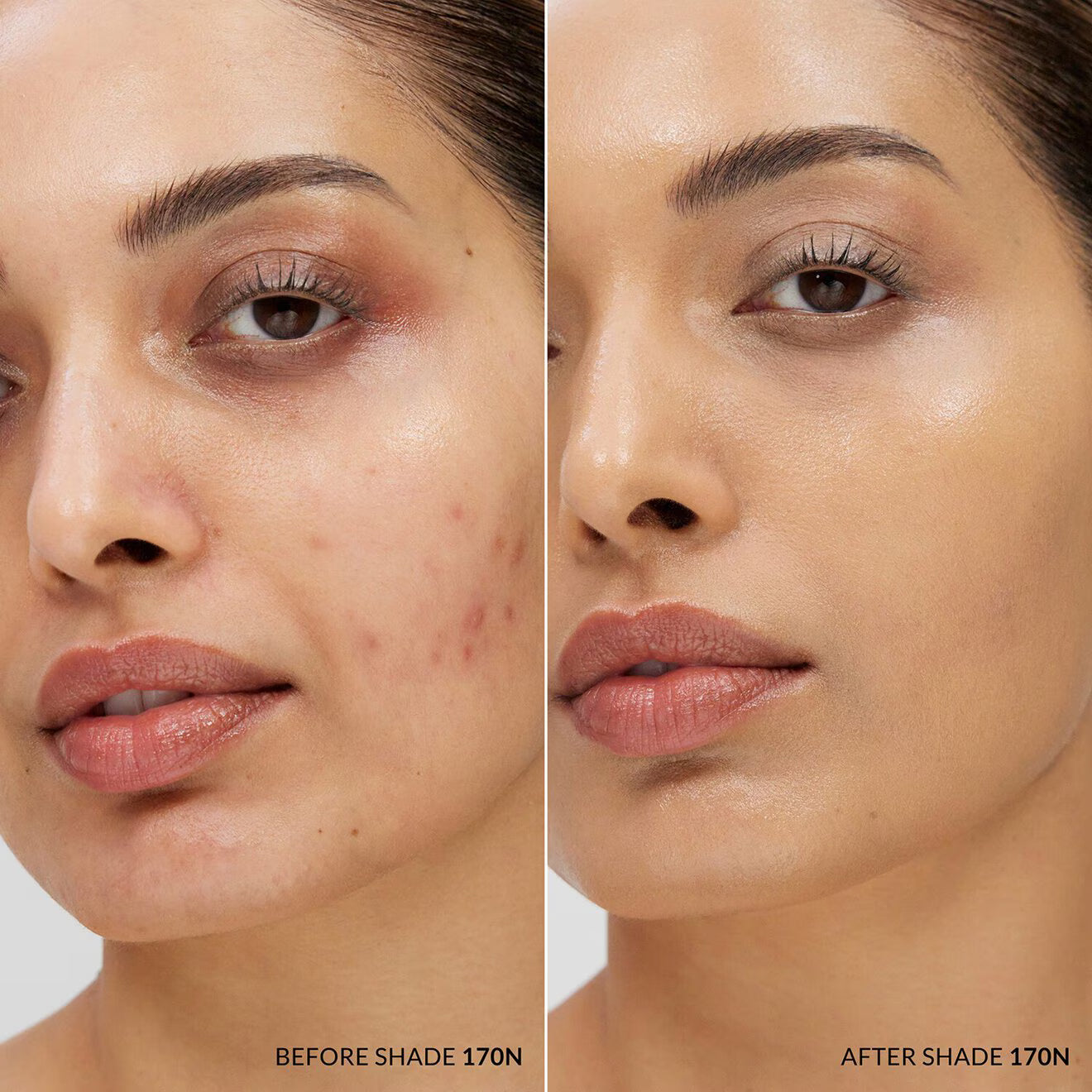 Skin Base