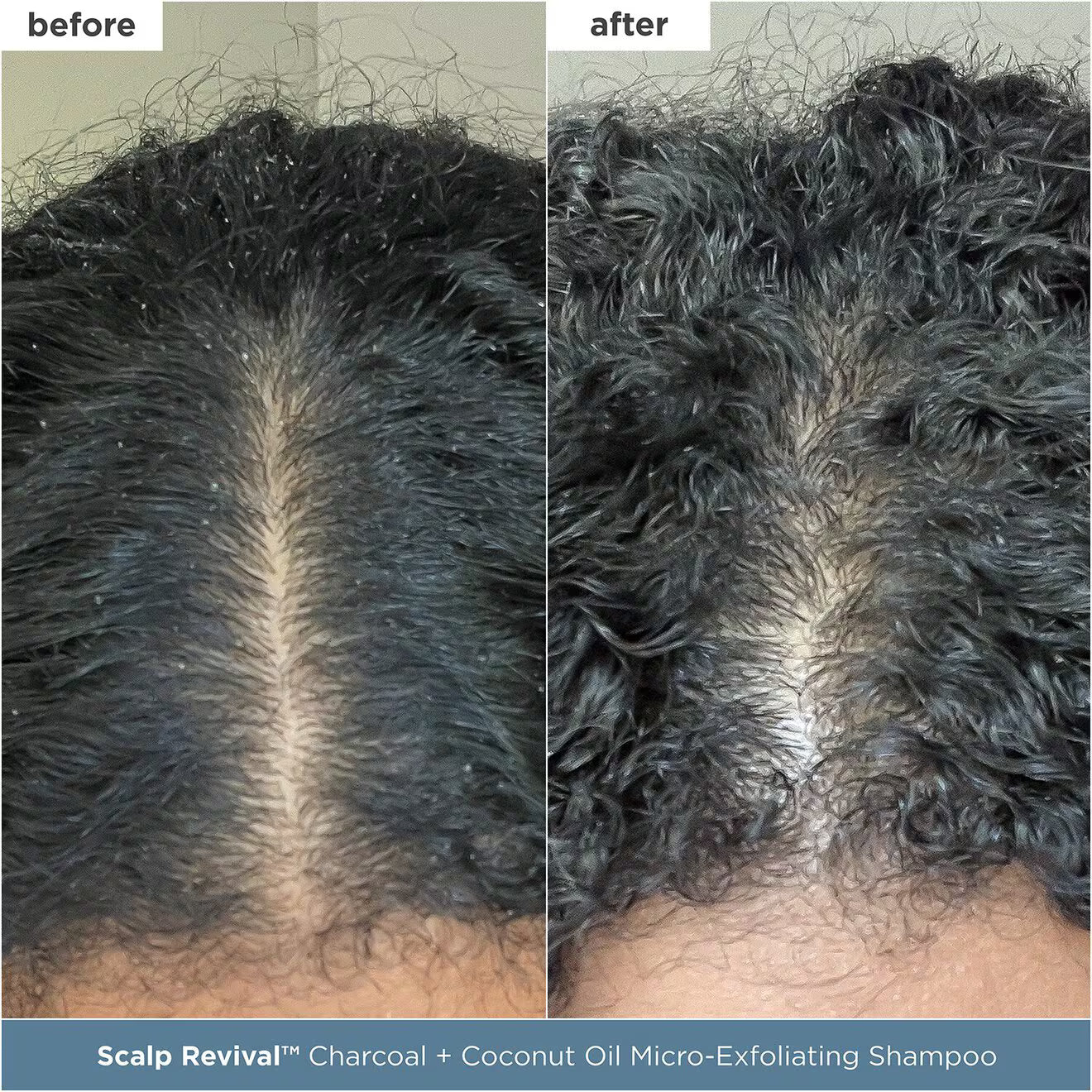 Scalp Revival Scalp-Soothing Starter Set