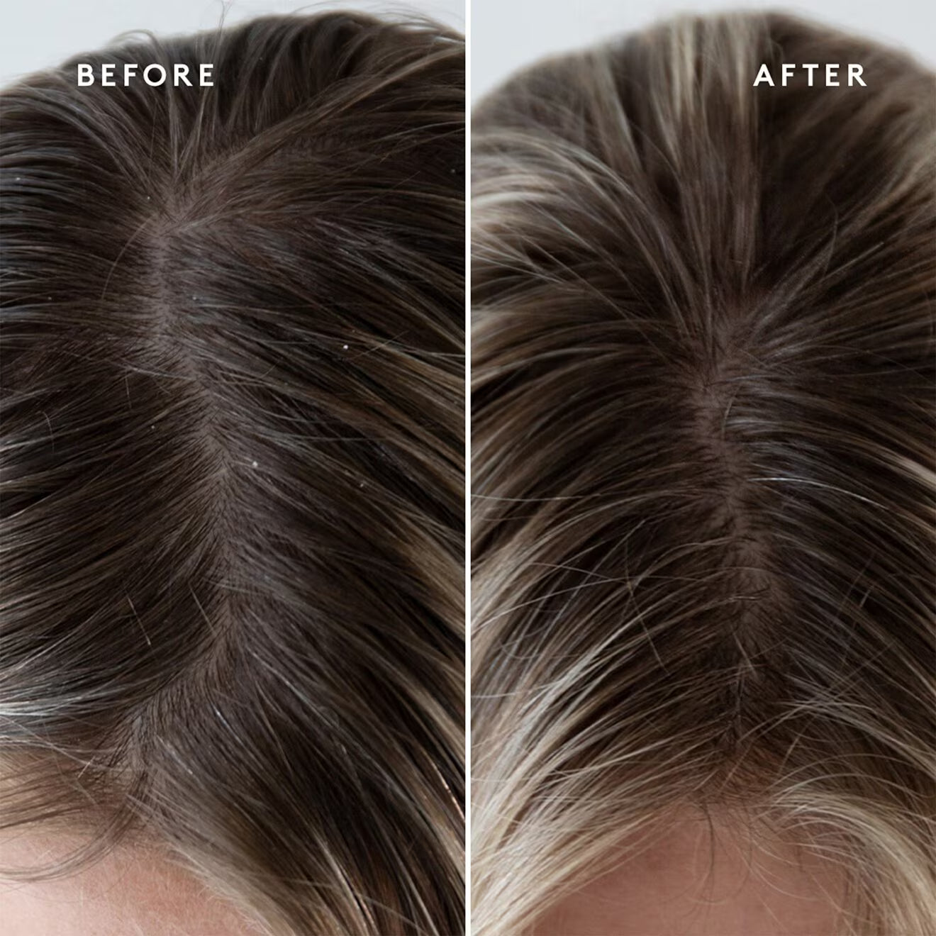 SCALP EXFOLIATING TREATMENT