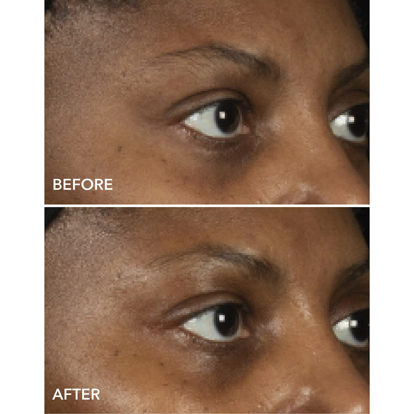 DermInfusions™ Lift + Repair Eye Mask