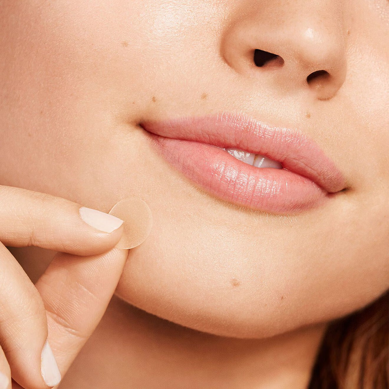 Acne Dots - Acne Healing Dots