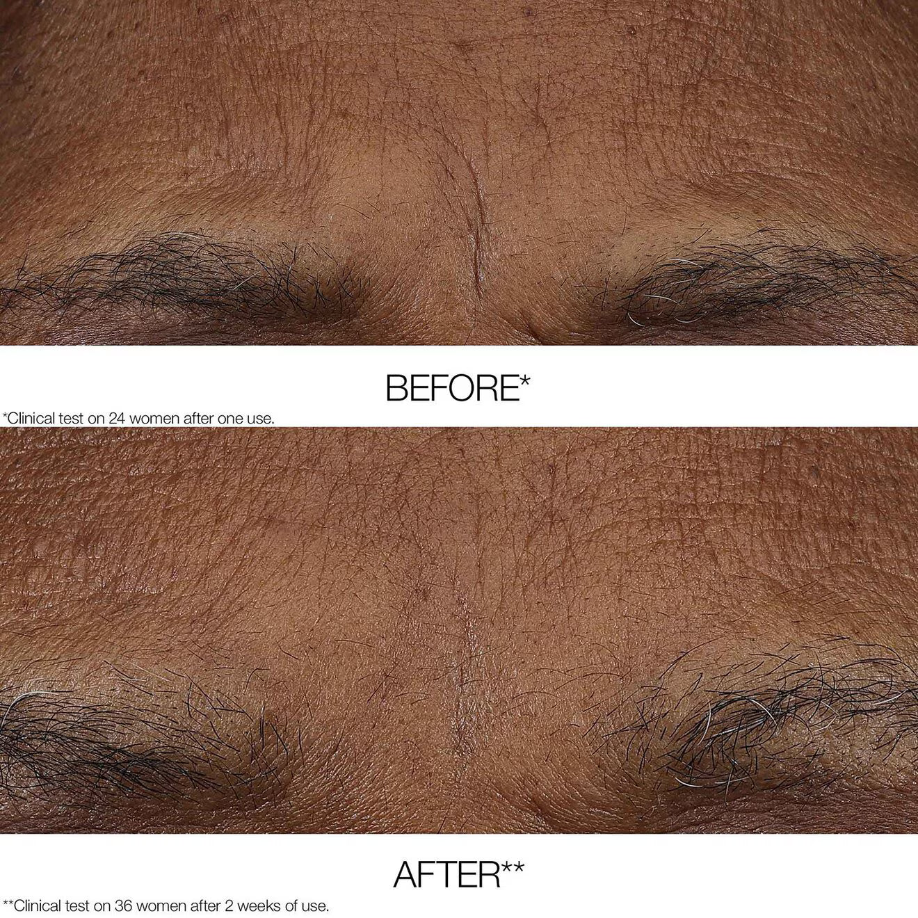 Smart Retinoid Balm