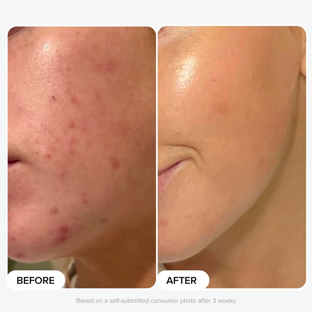 Protect And Glow Kit