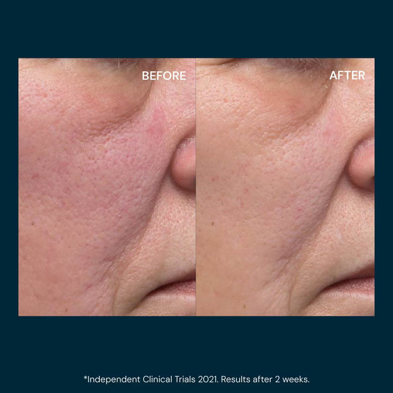 Dynamic Resurfacing Facial Pads - Pore Refining Exfoliating Pads