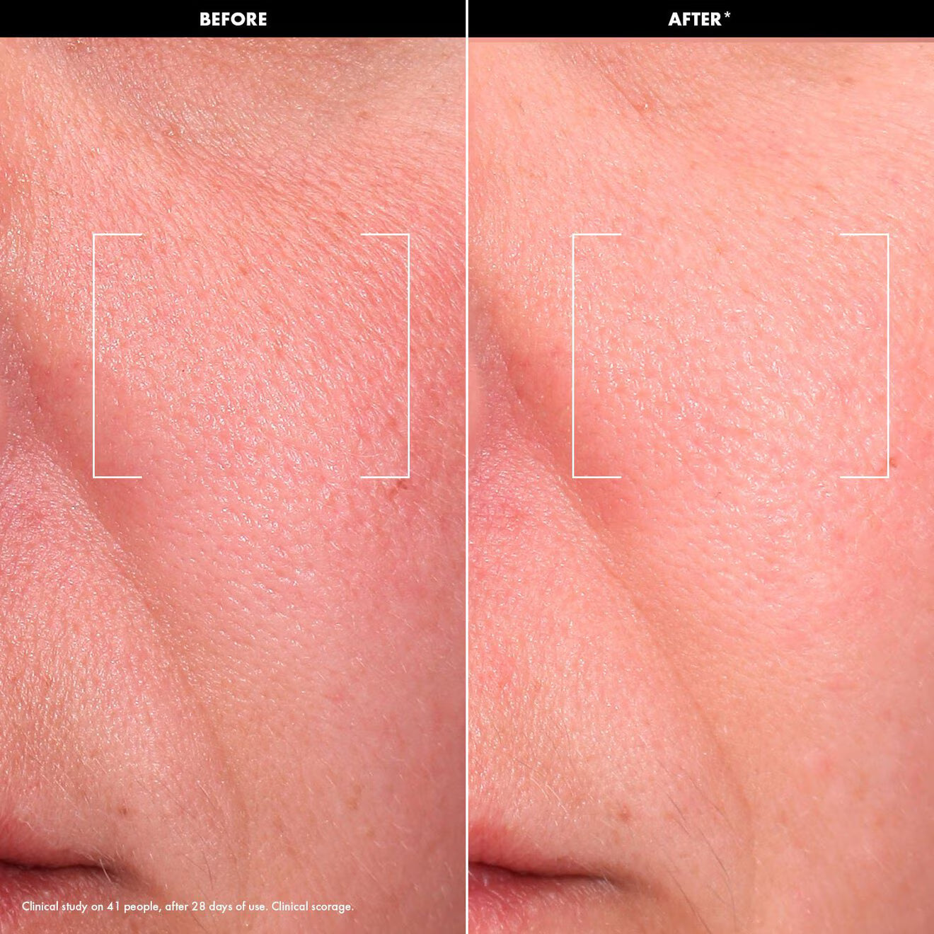 Let’s Get Glowy Set – Mini Radiance-Boosting Routine
