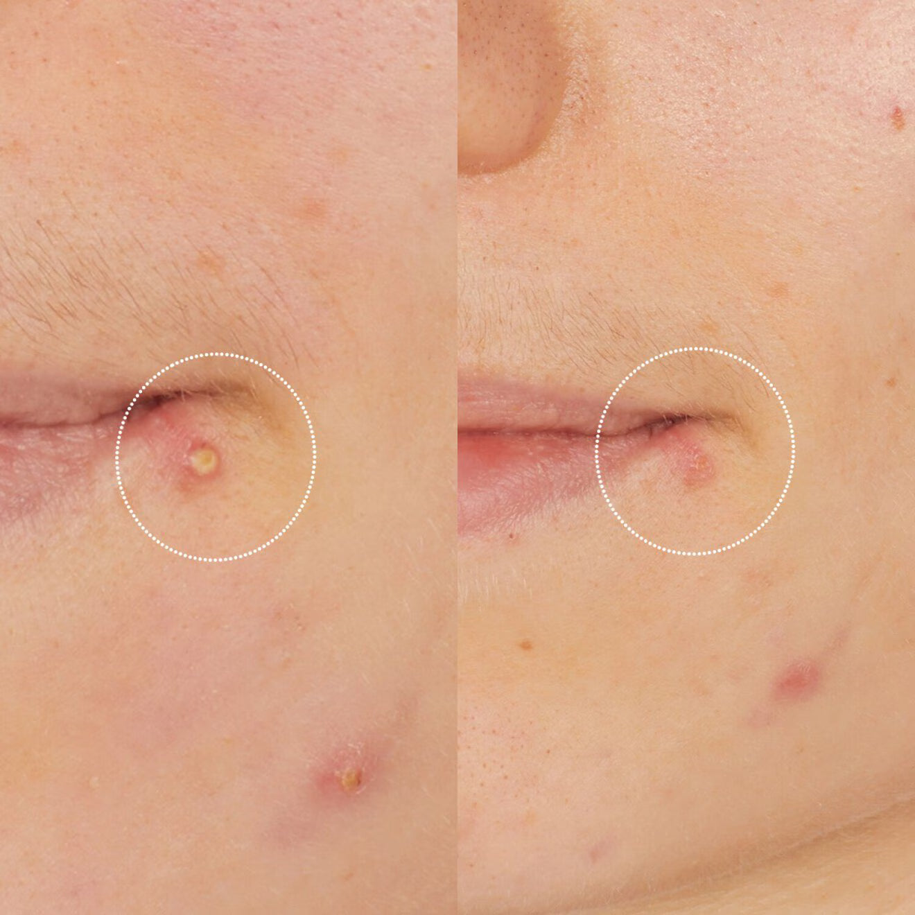 Vinopure Salicylic Stop Solution
