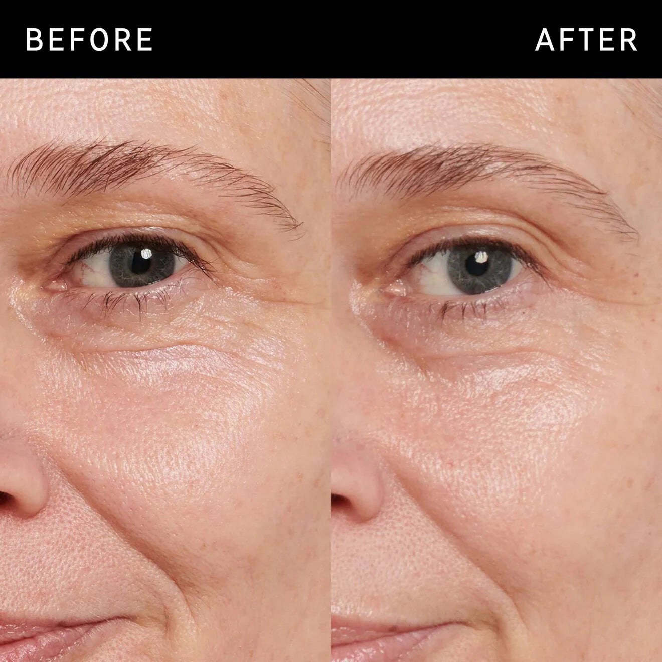 Retinol Eye Cream