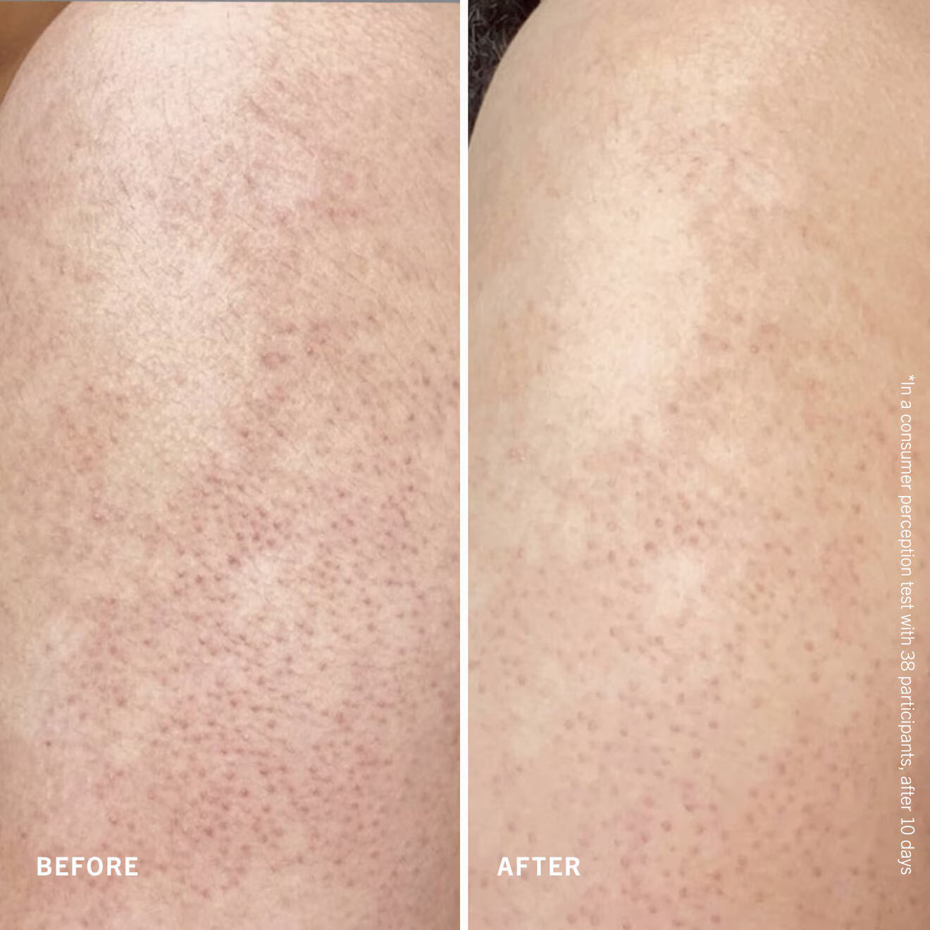 KP Smoothing Body Lotion with 10% AHA + UREA Fresh Peach