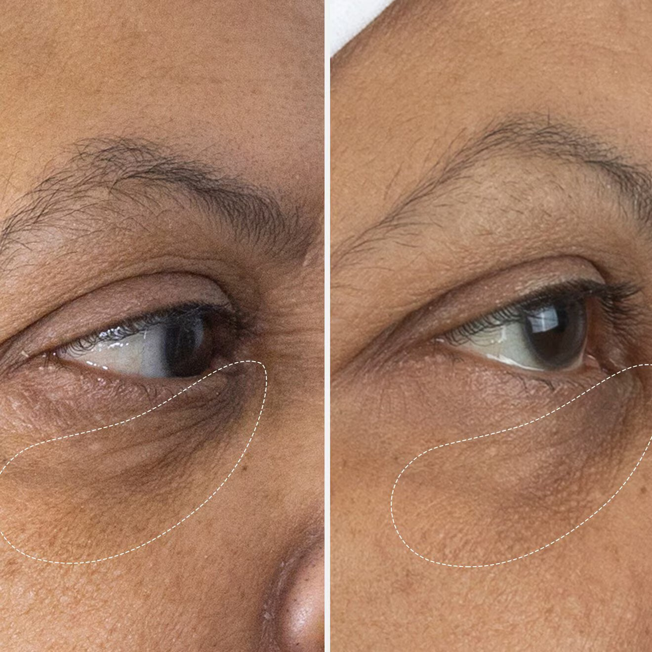 The Eye Cream - Nomad