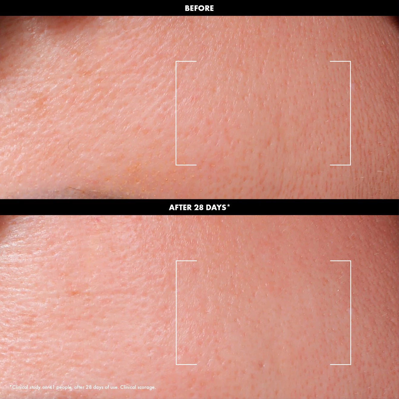 Exfoliate Daily Resurfacing Toner – 3% AHA + 2% Vitamin C