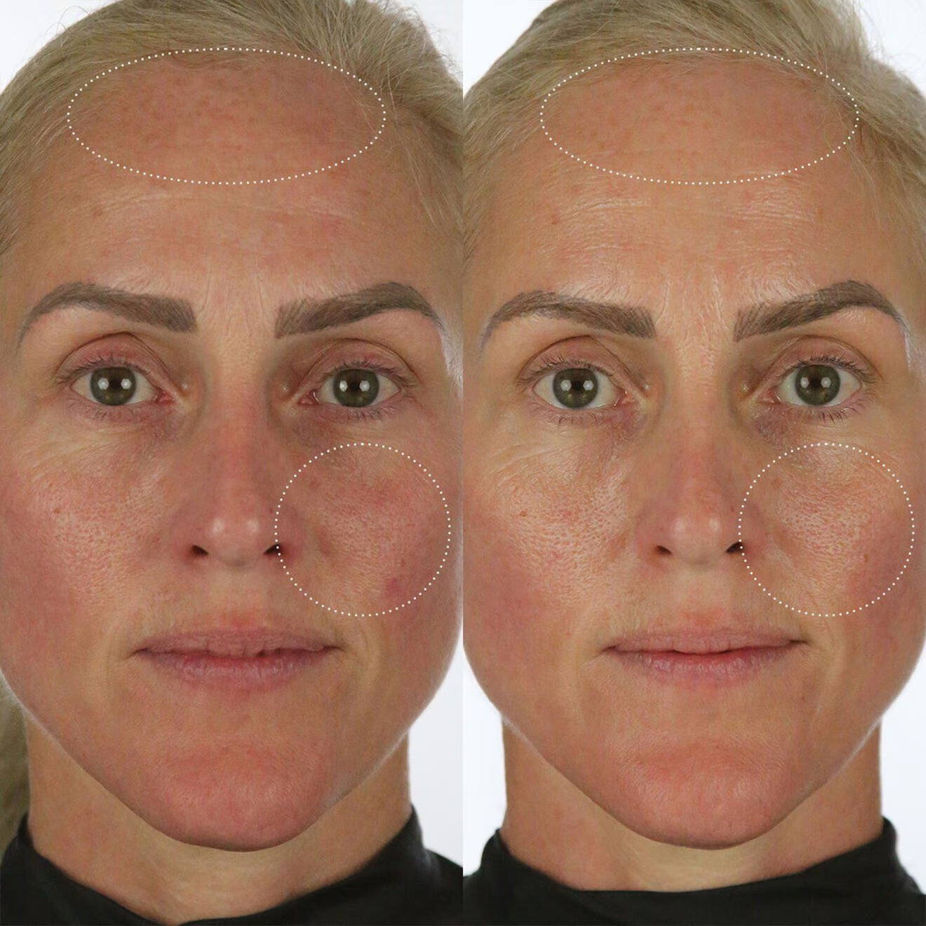 Milky Sunscreen SPF 50