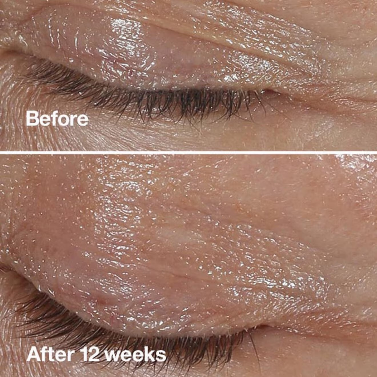 Smart Clinical Repair™ Wrinkle Correcting Eye Cream