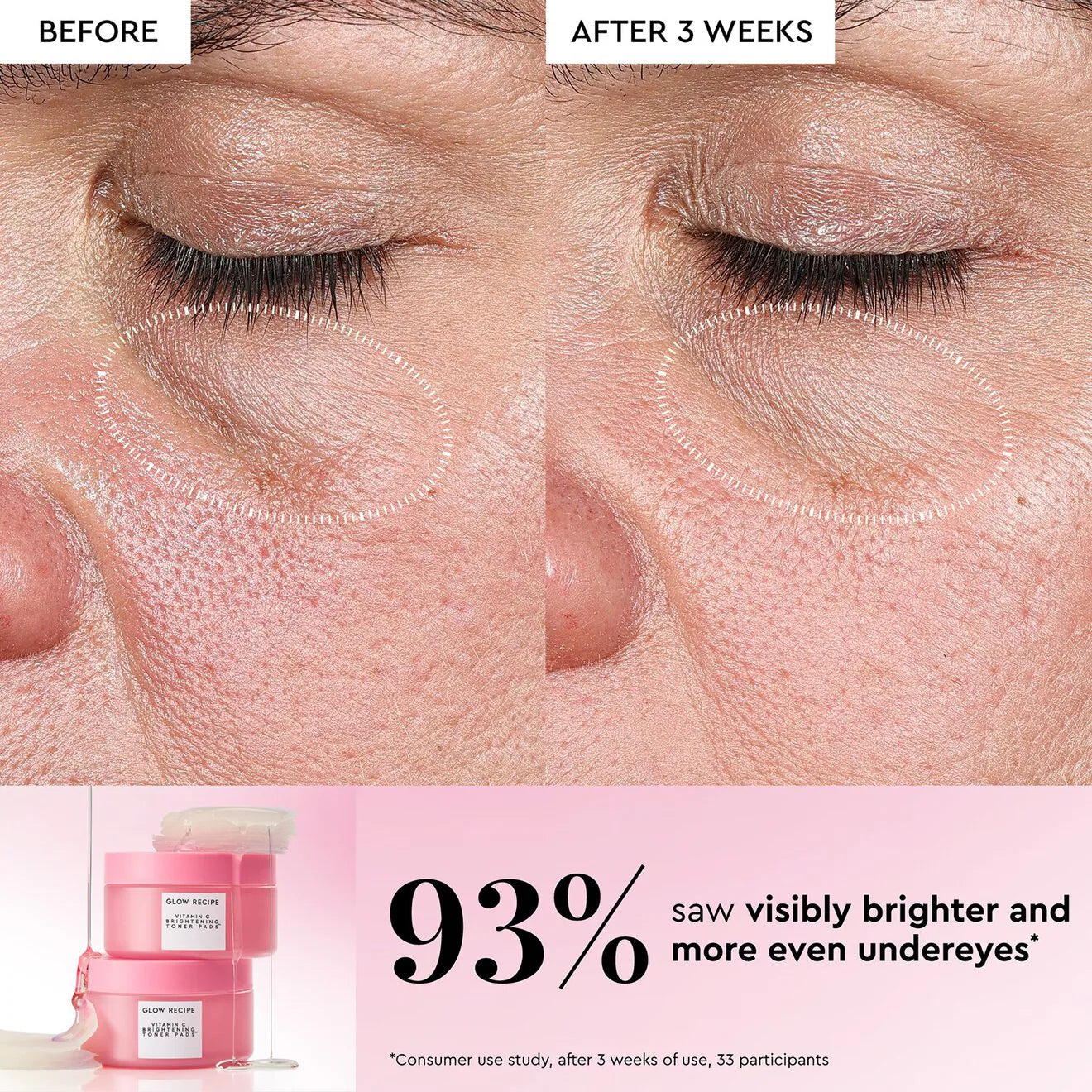 Vitamin C Brightening Korean Toner Pads for Undereye & Cheeks