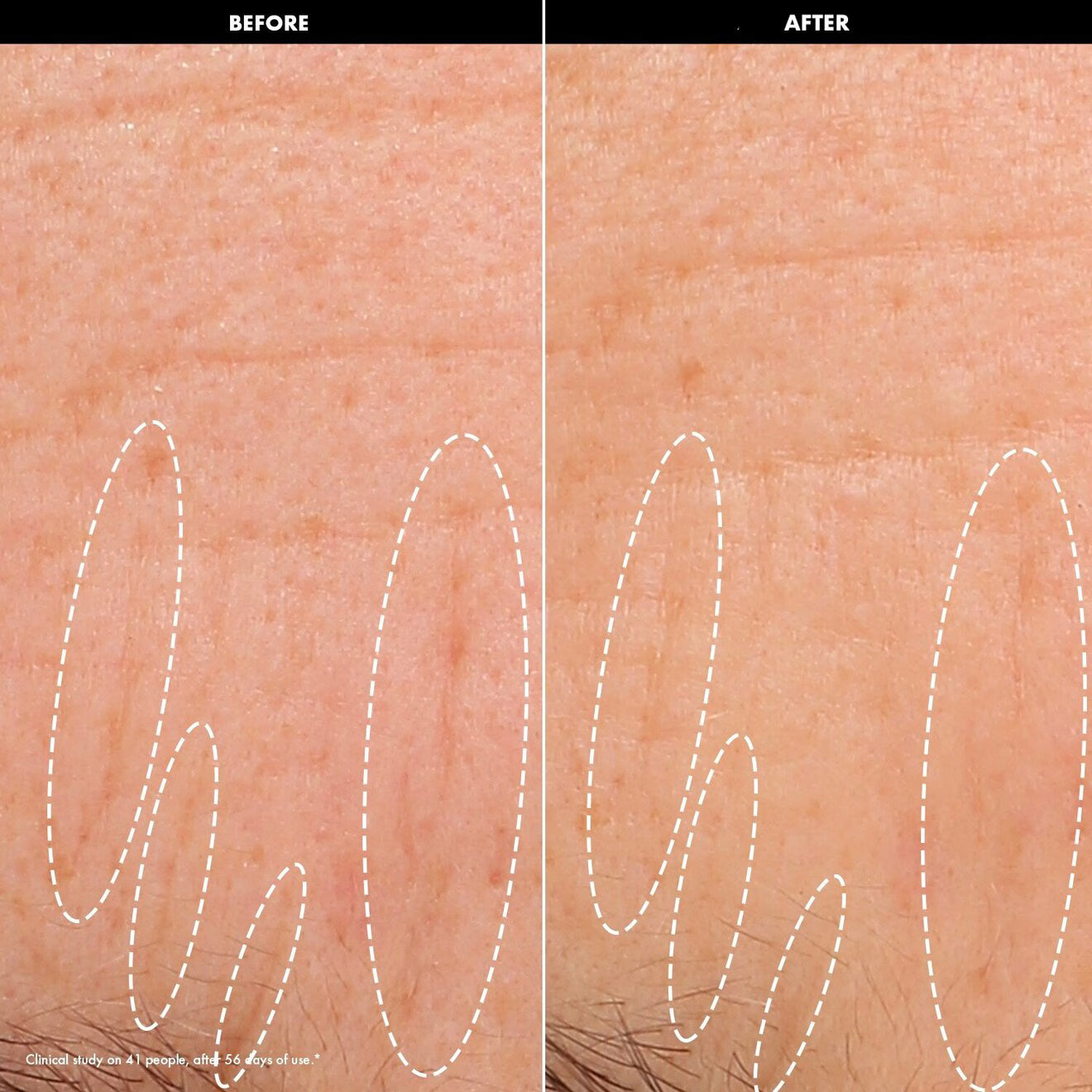 Lift & Firm – Recovery Firming Night Cream with Peptides
