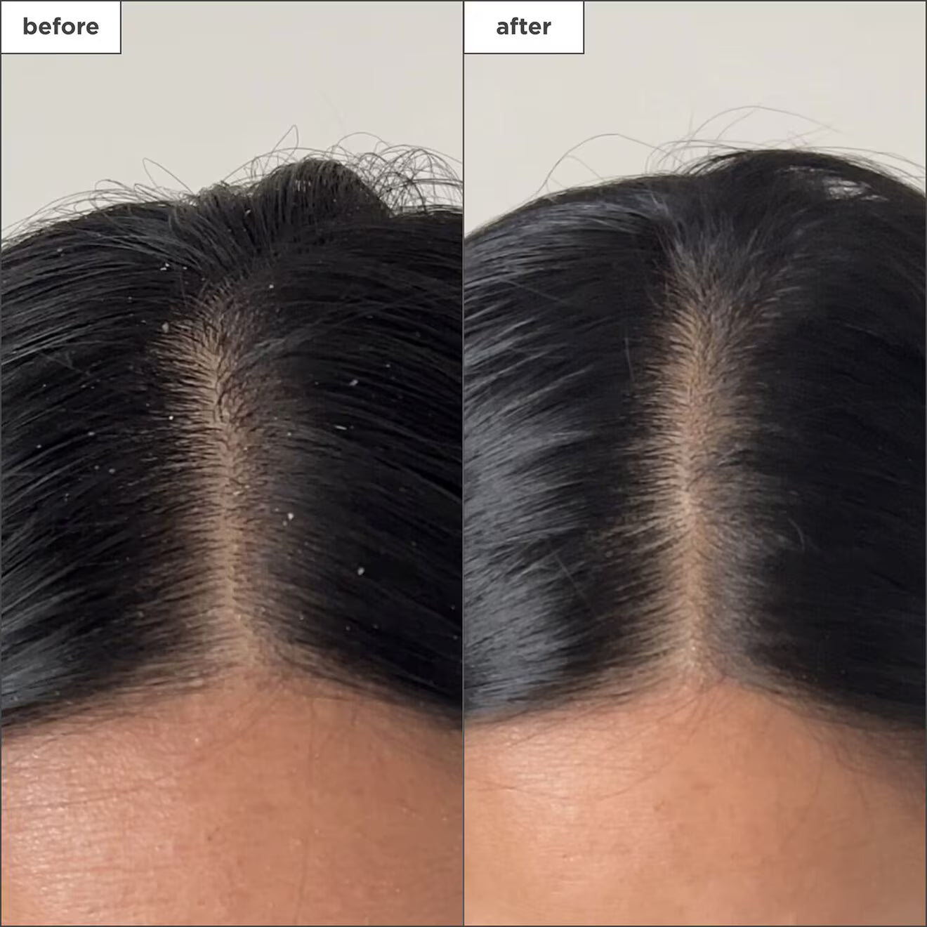 Scalp Revival™ Charcoal + Tea Tree Buildup Detox Spray