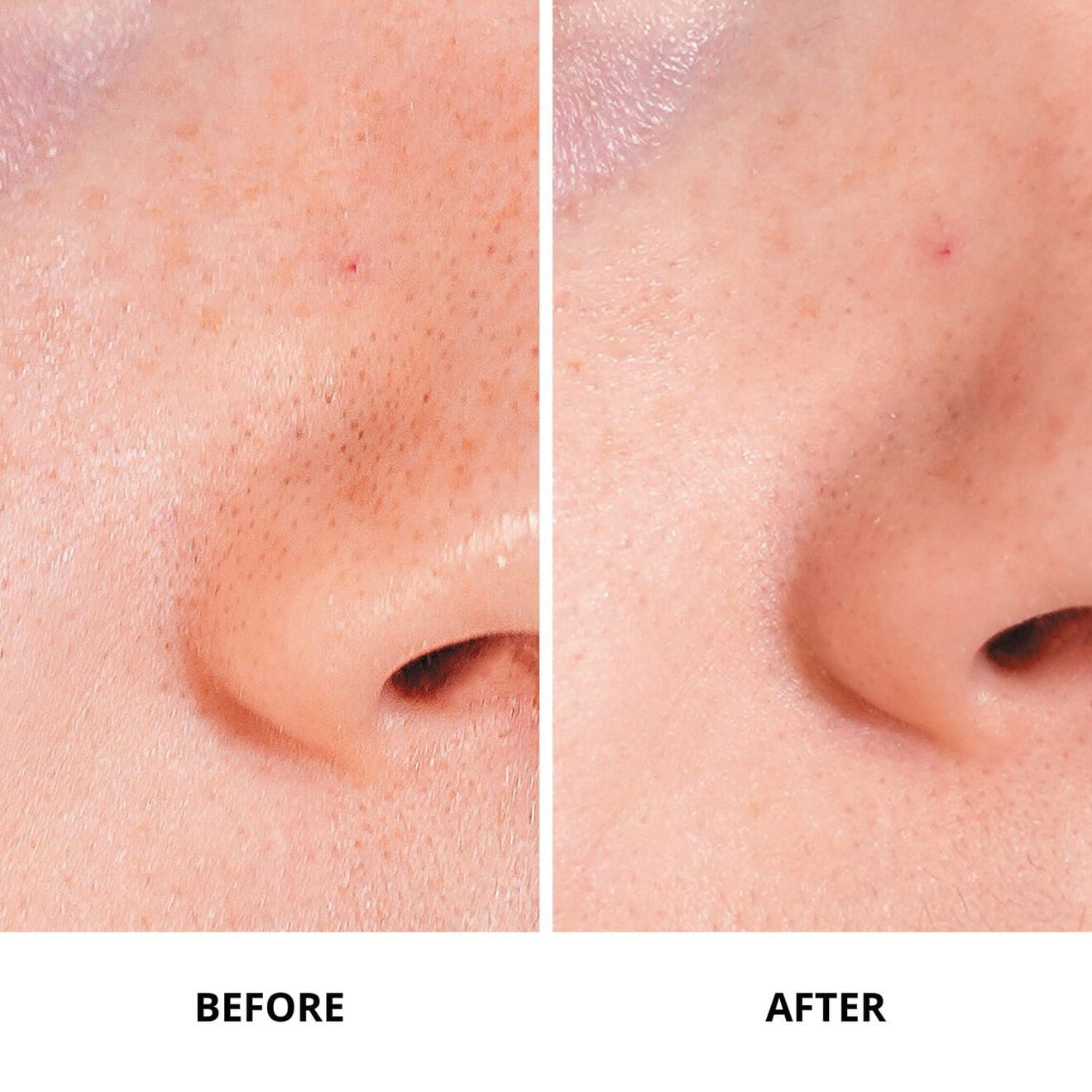 Ginseng Micro Shot Starter 0.1% - Retexturizing Micro-Infusion Serum