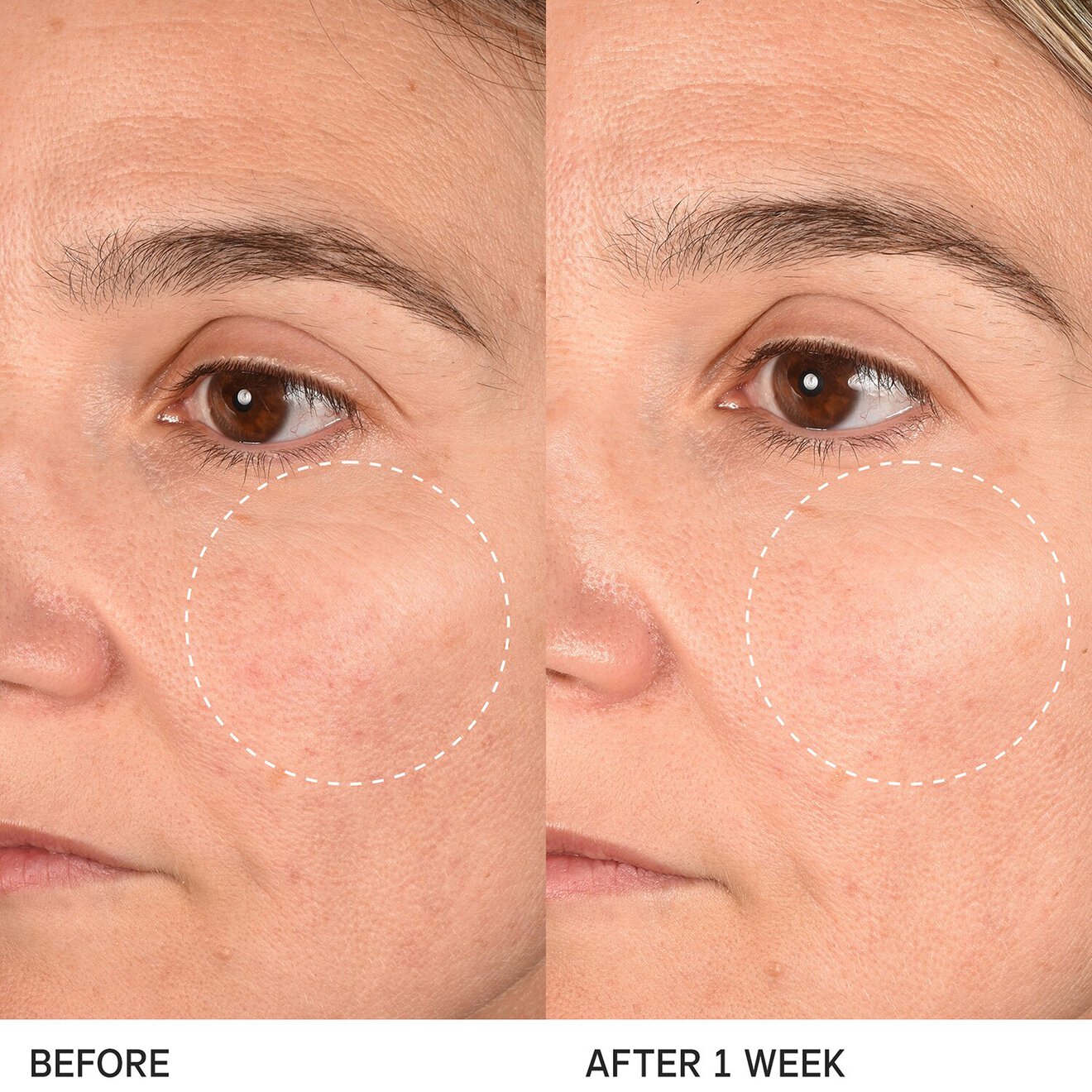 The Longevity Memory Cream