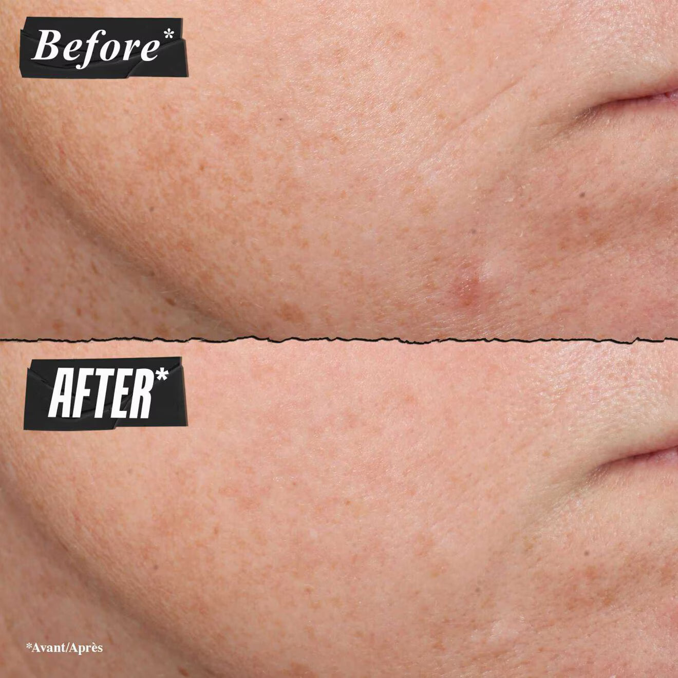 Retinol Skin-Renewing Daily Micro-Dose Anti-Aging Serum with Ceramide