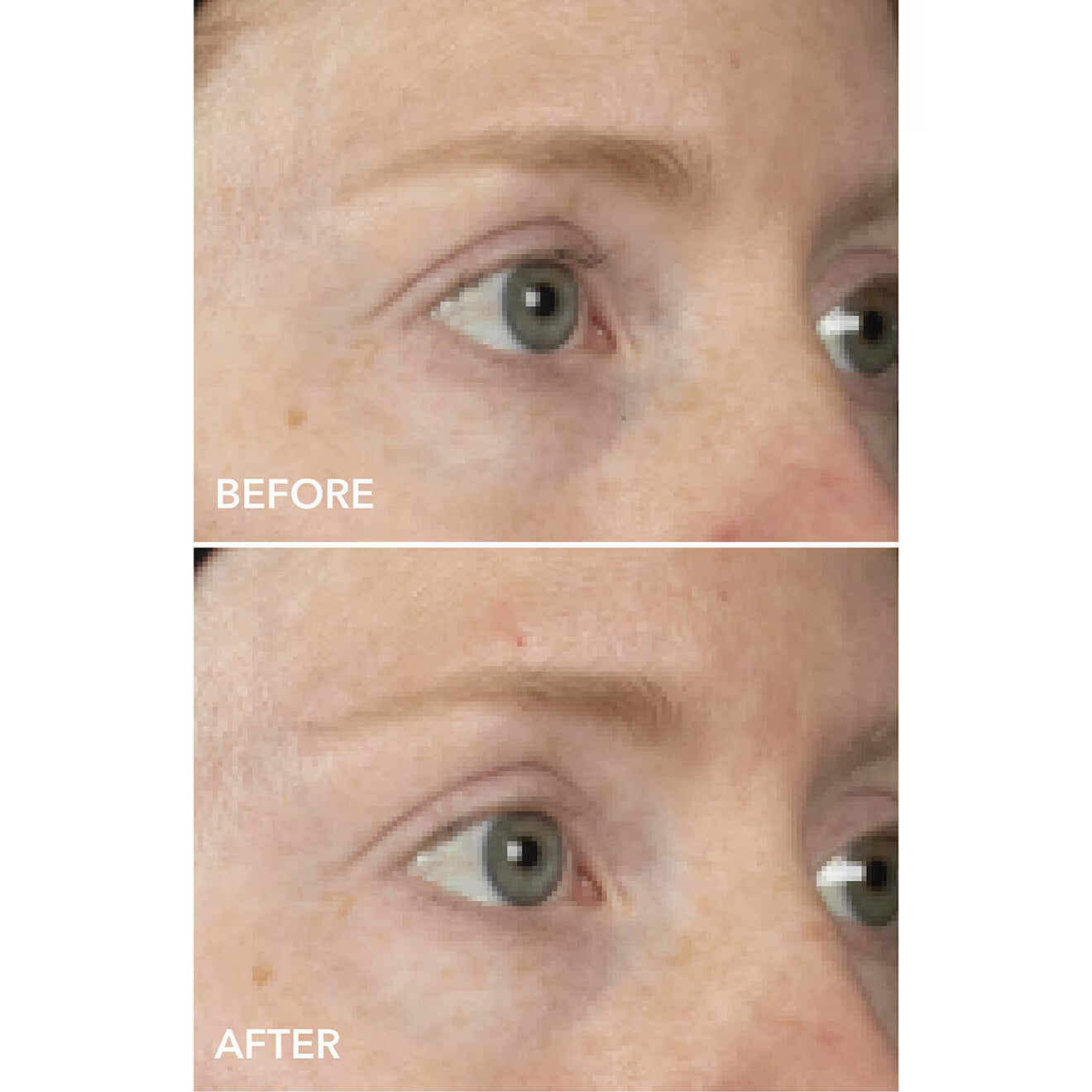 DermInfusions™ Lift + Repair Eye Mask