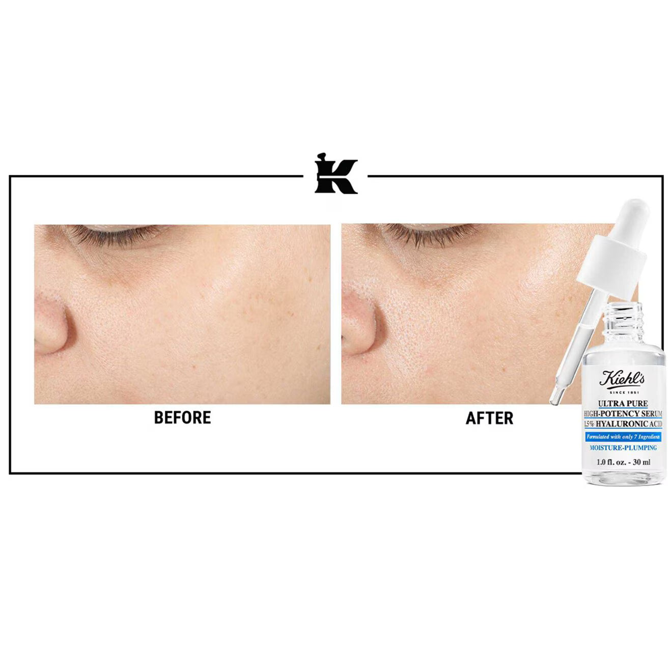 Up-The-Moisture Starter Kit