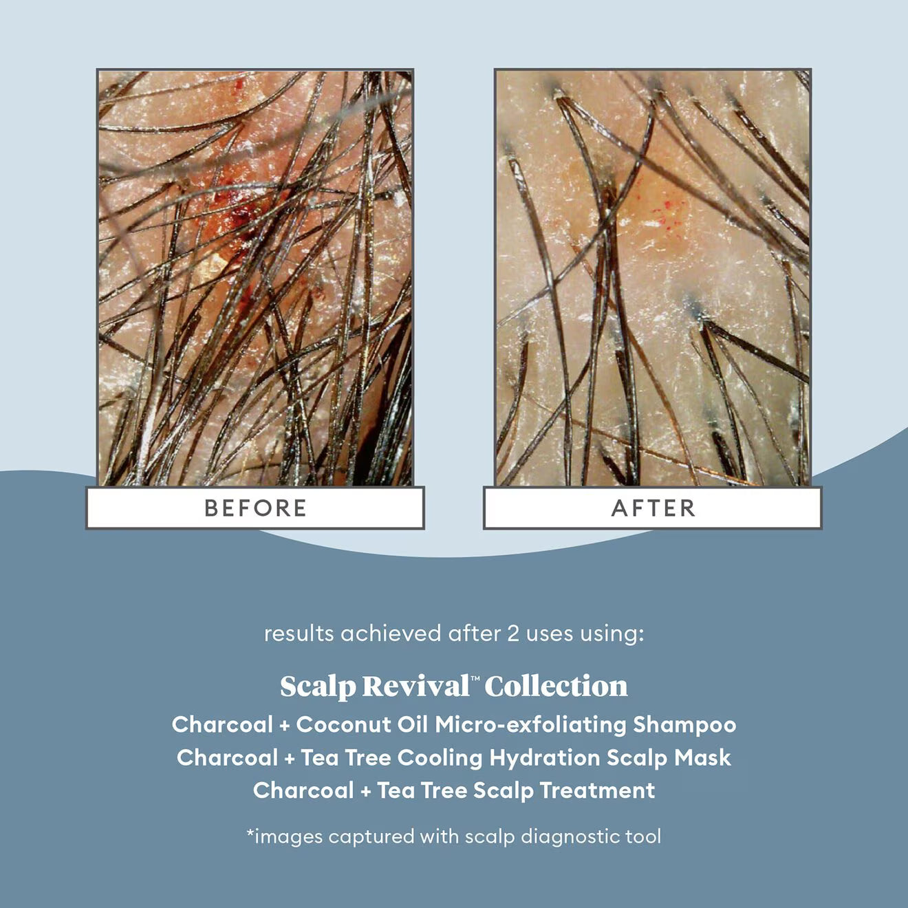Scalp Revival™ Charcoal + Coconut Oil Micro-exfoliating Shampoo