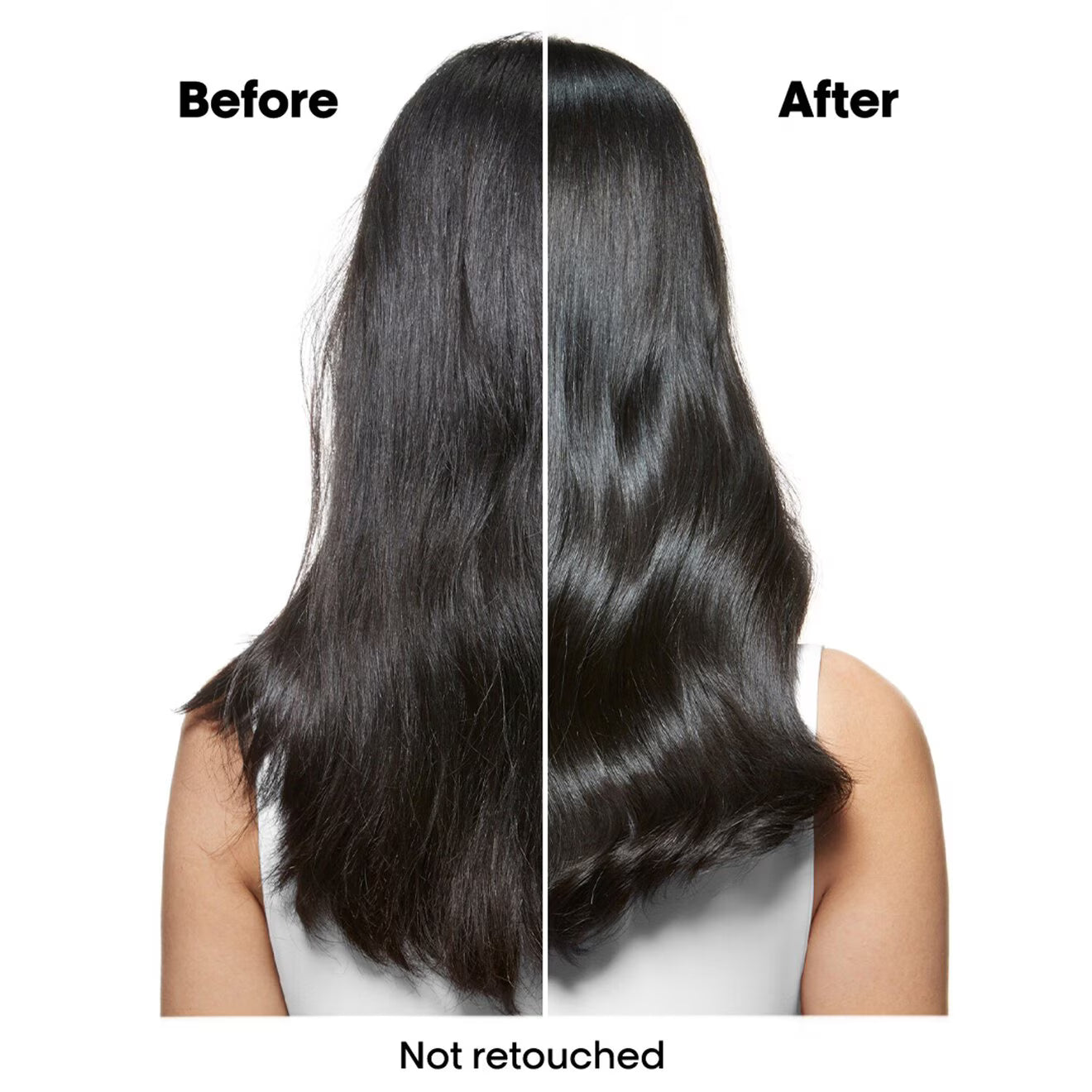 Scalp Advanced Anti-Dandruff Shampoo, For Dandruff Scalps