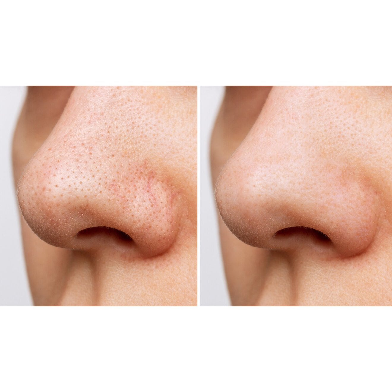 Heartleaf Pore Control Cleansing Oil