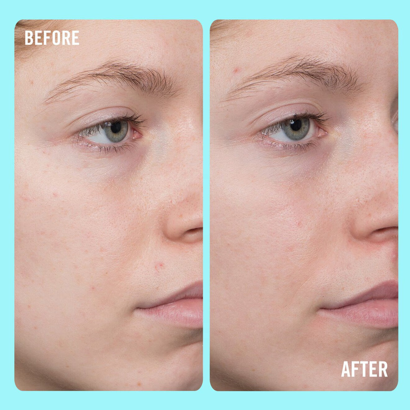 10% Vitamin C Brightening Serum