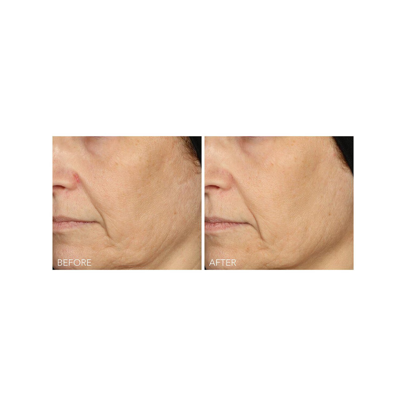 Vitamin C + Lactic 15% Vitamin C Firm & Bright Serum