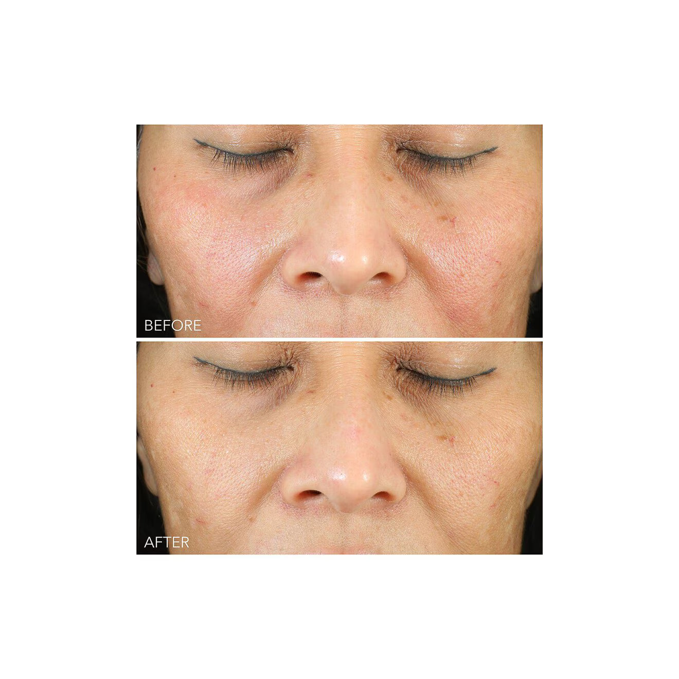Vitamin C + Lactic Oil-Free Radiant Moisturizer