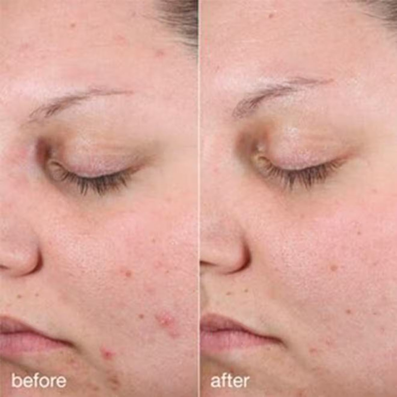 Age Bright Clearing Serum