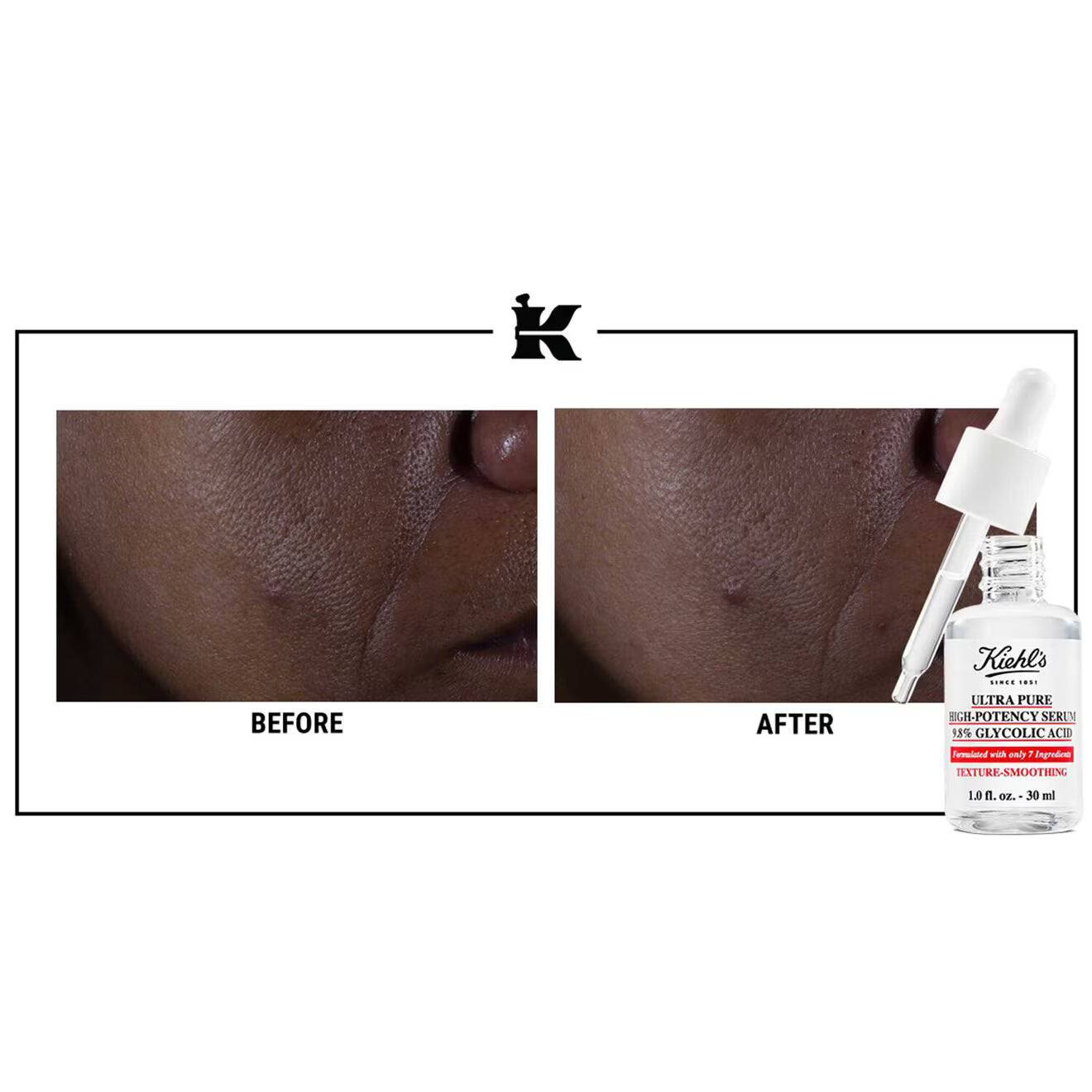 Ultra Pure High-Potency Serum 9.8% Glycolic Acid