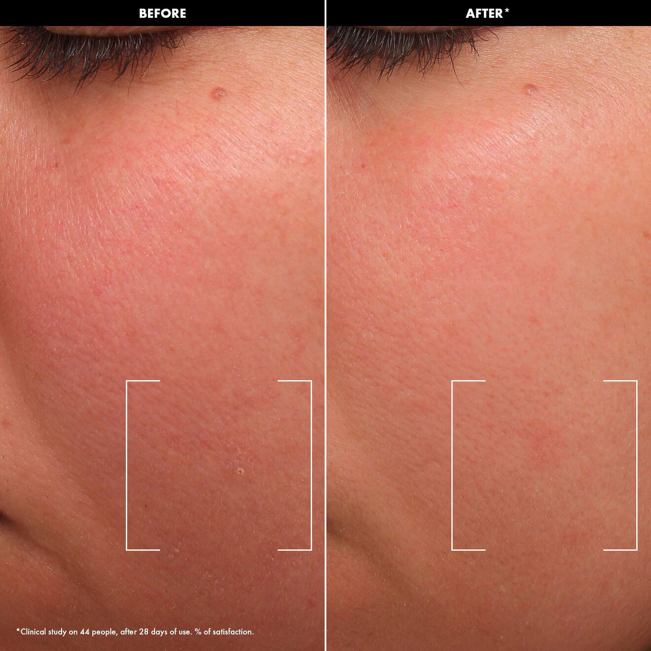 Hydrate – Balmy Rich Cream with Lipids and Ceramides