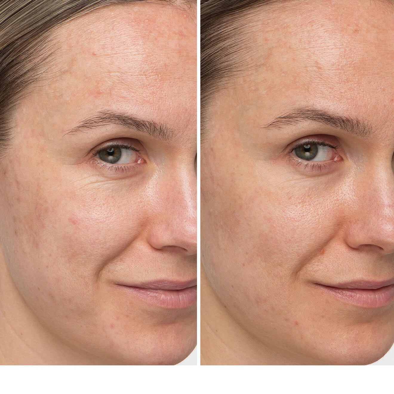 Confidence in a Cream Supercharged - Anti-Aging Hydrating Moisturizer