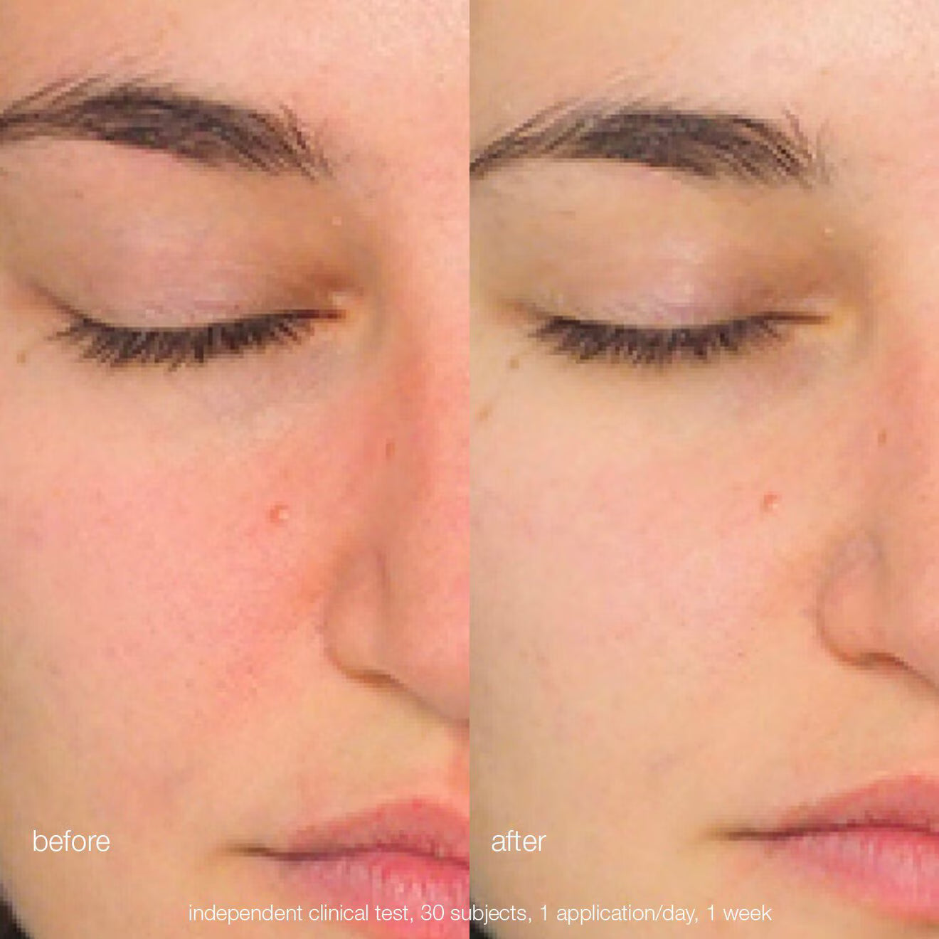 Daily Milkfoliant Exfoliator