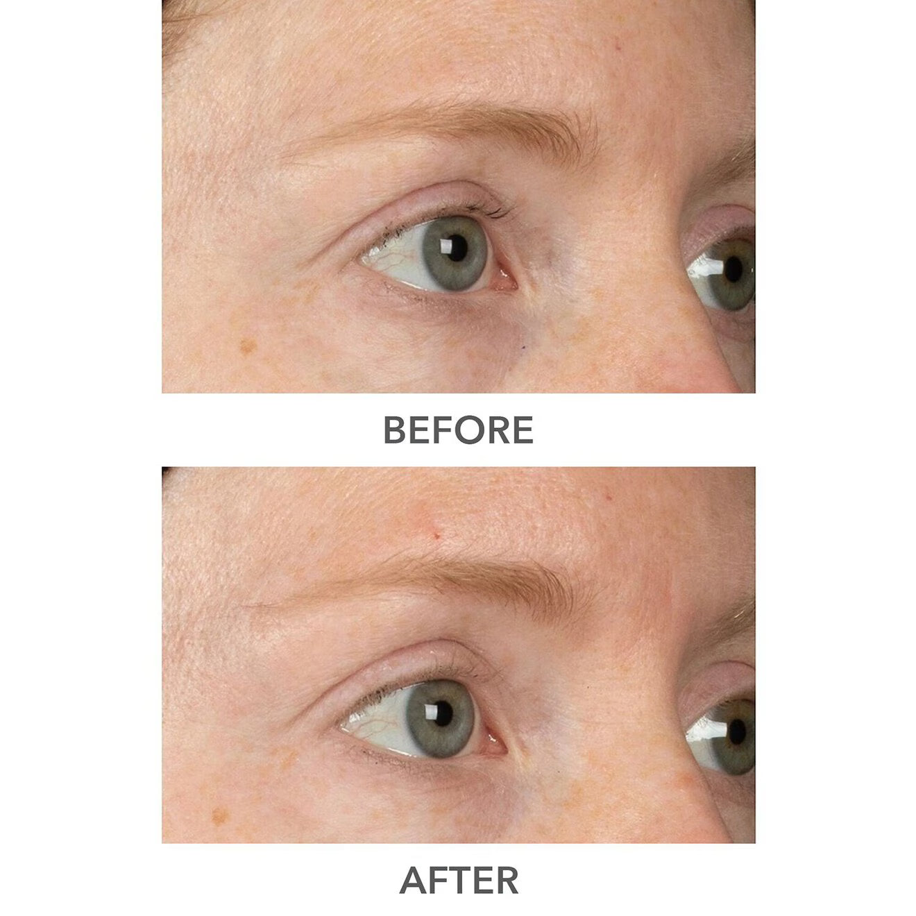 Derminfusions 3D Plump, Fill & Repair Kit (Lip Treatment, Serum & Eye Mask)